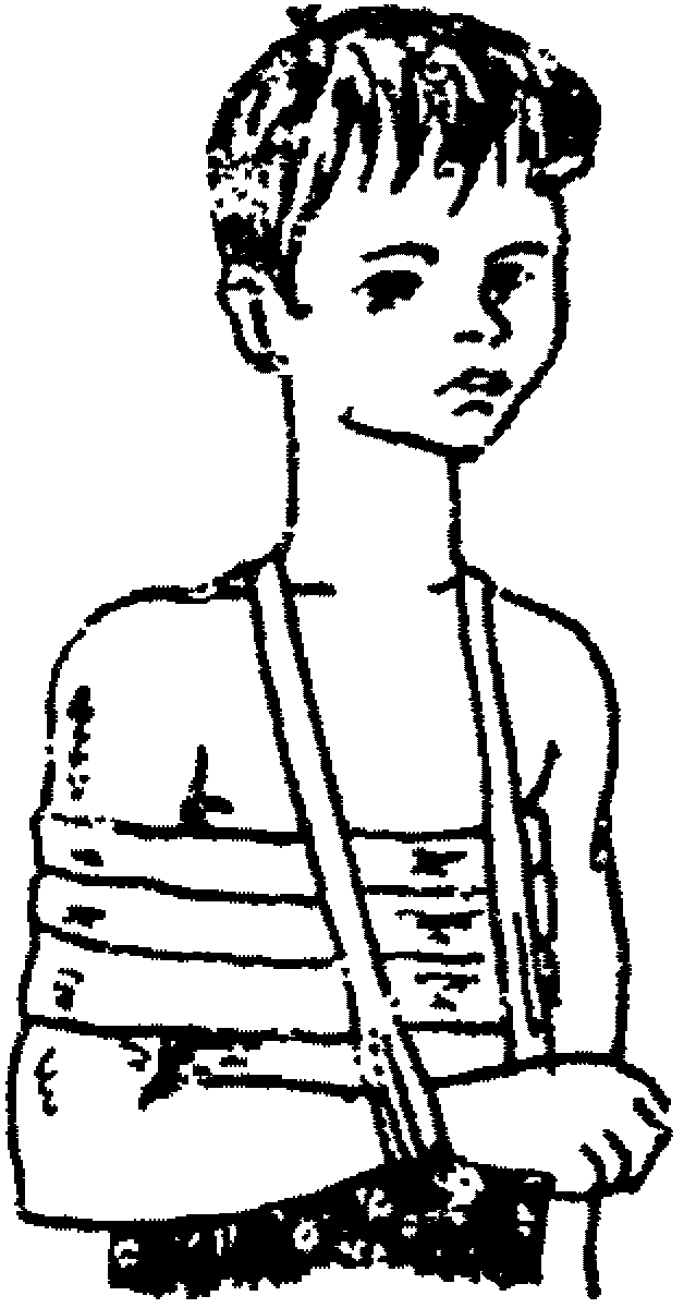 рис. 29