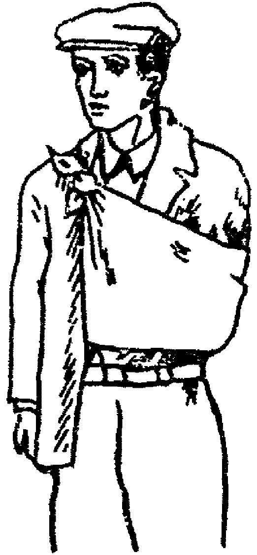 рис. 33